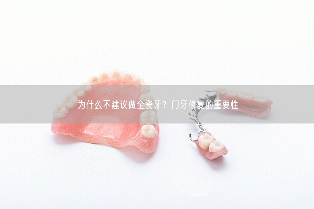为什么不建议做全瓷牙？门牙修复的重要性