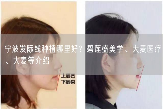 宁波发际线种植哪里好？碧莲盛美学、大麦医疗、大麦等介绍