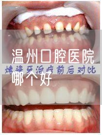 温州口腔医院哪个好
