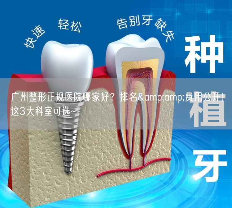广州整形正规医院哪家好？排名&amp;费用公开！这3大科室可选~