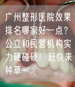 广州整形医院效果排名哪家好一点？公立和民营机构实力硬碰硬！赶快来种草~