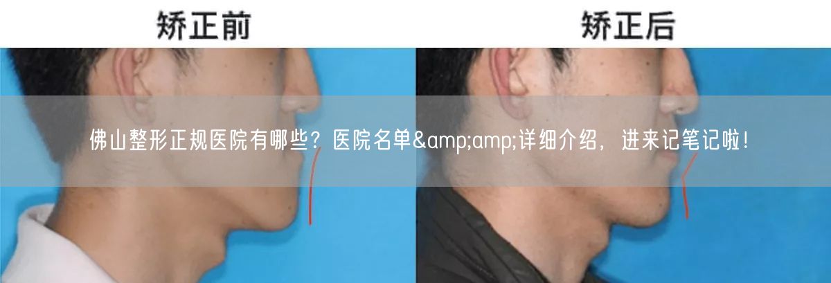 佛山整形正规医院有哪些？医院名单&amp;详细介绍，进来记笔记啦！