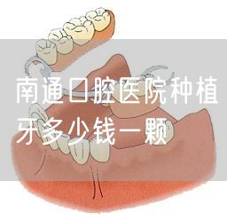 南通口腔医院种植牙多少钱一颗