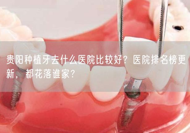 贵阳种植牙去什么医院比较好？医院排名榜更新，都花落谁家？