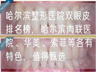哈尔滨整形医院双眼皮排名榜，哈尔滨肉联医院、华美、索菲等各有特色，值得甄选