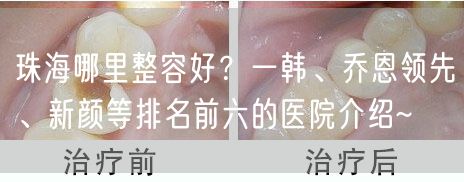珠海哪里整容好？一韩、乔恩领先、新颜等排名前六的医院介绍~