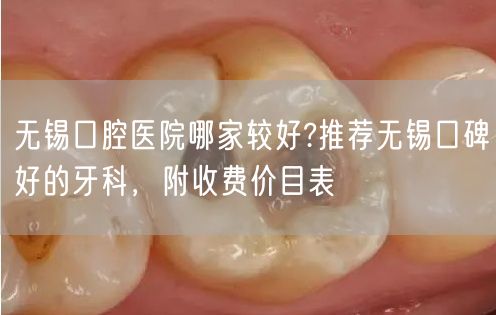 无锡口腔医院哪家较好?推荐无锡口碑好的牙科，附收费价目表