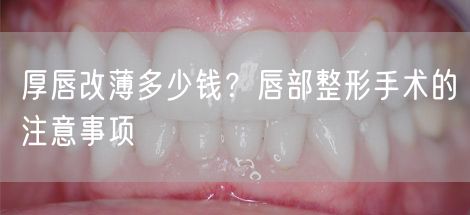 厚唇改薄多少钱？唇部整形手术的注意事项