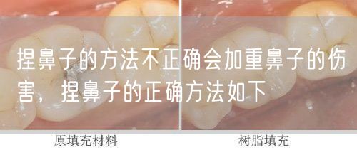 捏鼻子的方法不正确会加重鼻子的伤害，捏鼻子的正确方法如下