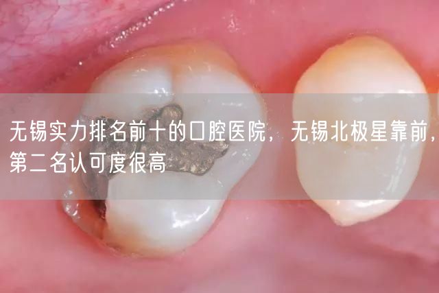 无锡实力排名前十的口腔医院，无锡北极星靠前，第二名认可度很高