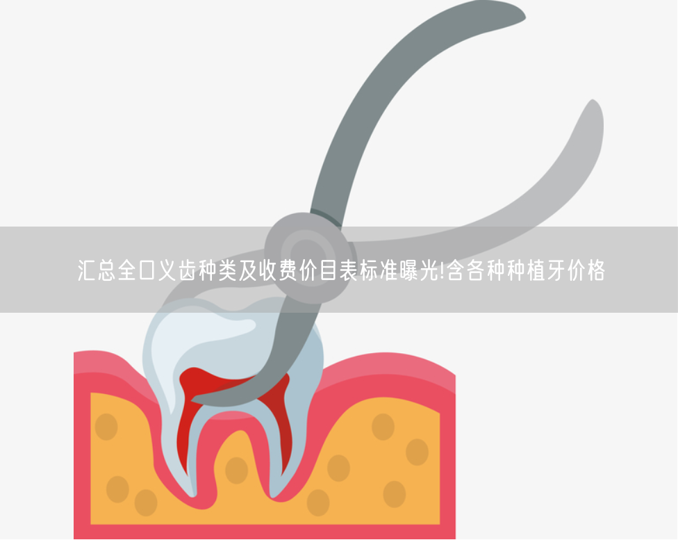 汇总全口义齿种类及收费价目表标准曝光!含各种种植牙价格