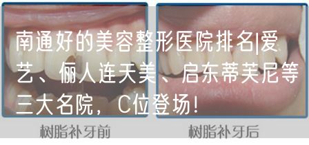 南通好的美容整形医院排名|爱婍艺、俪人连天美、启东蒂芙尼等三大名院，C位登场！