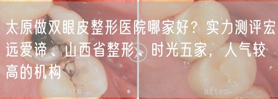 太原做双眼皮整形医院哪家好？实力测评宏远爱谛、山西省整形、时光五家，人气较高的机构