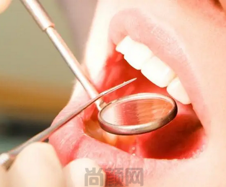 泰康拜博口腔怎么样 正规靠谱的连锁机构附种牙价格