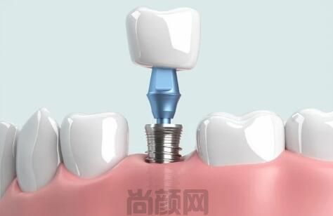 2023银川口腔医院看牙收费价格表更新，其中补牙、拔智齿价格都不贵哦~