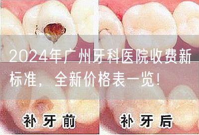 2024年广州牙科医院收费新标准，全新价格表一览！(图1)