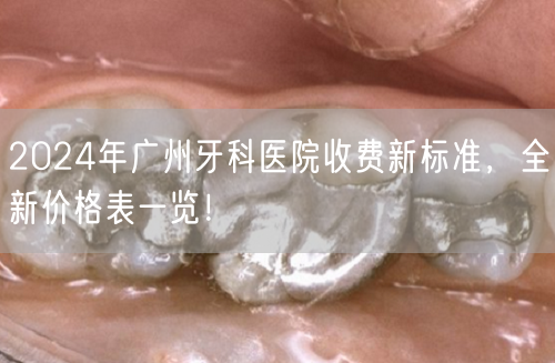 2024年广州牙科医院收费新标准，全新价格表一览！