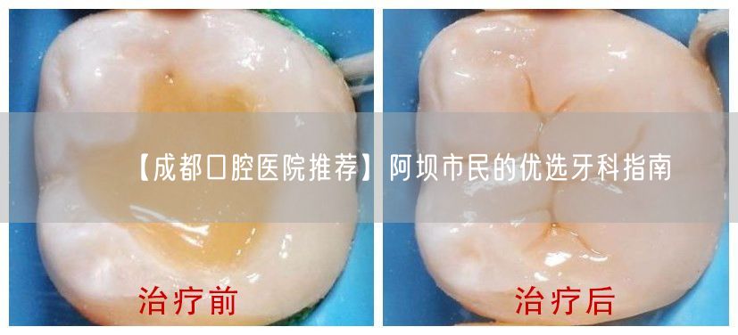 【成都口腔医院推荐】阿坝市民的优选牙科指南(图1)