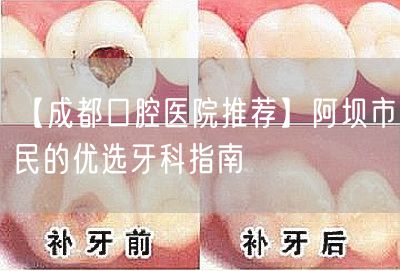 【成都口腔医院推荐】阿坝市民的优选牙科指南