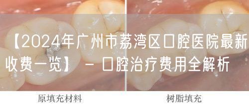 【2024年广州市荔湾区口腔医院最新收费一览】 - 口腔治疗费用全解析