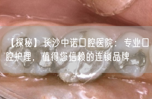 【探秘】长沙中诺口腔医院：专业口腔护理，值得您信赖的连锁品牌