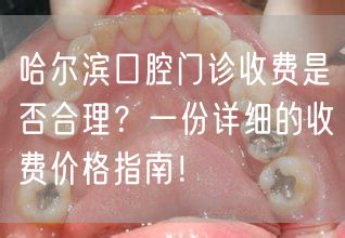 哈尔滨口腔门诊收费是否合理？一份详细的收费价格指南！