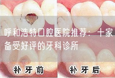 呼和浩特口腔医院推荐：十家备受好评的牙科诊所(图1)