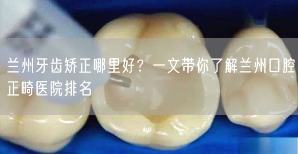 兰州牙齿矫正哪里好？一文带你了解兰州口腔正畸医院排名