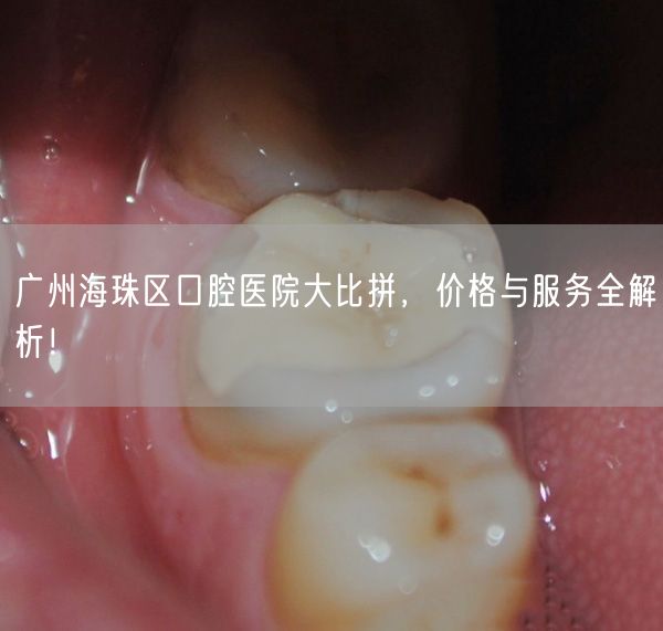 广州海珠区口腔医院大比拼，价格与服务全解析！(图1)
