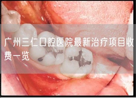 广州三仁口腔医院最新治疗项目收费一览
