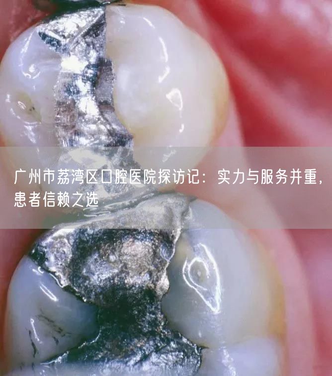 广州市荔湾区口腔医院探访记：实力与服务并重，患者信赖之选