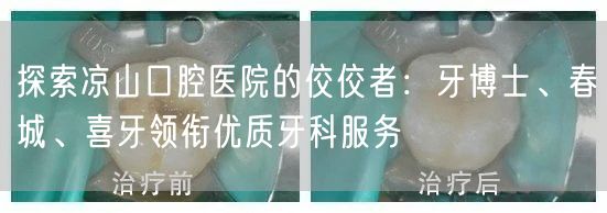 探索凉山口腔医院的佼佼者：牙博士、春城、喜牙领衔优质牙科服务