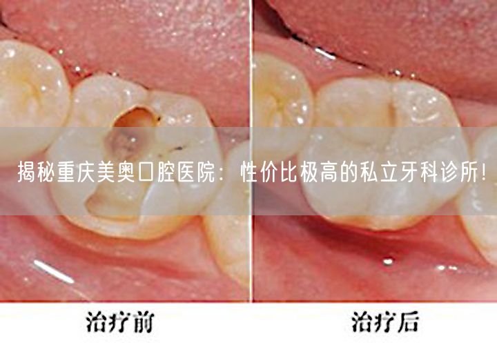 揭秘重庆美奥口腔医院：性价比极高的私立牙科诊所！