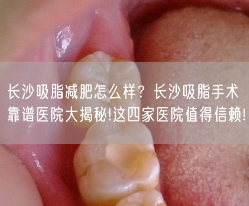 长沙吸脂减肥怎么样？长沙吸脂手术靠谱医院大揭秘!这四家医院值得信赖!