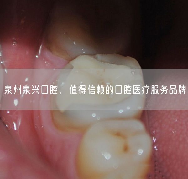 泉州泉兴口腔，值得信赖的口腔医疗服务品牌