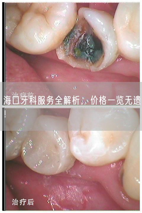 海口牙科服务全解析，价格一览无遗！(图1)
