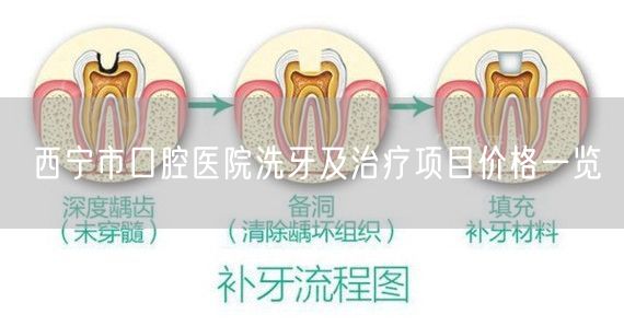 西宁市口腔医院洗牙及治疗项目价格一览
