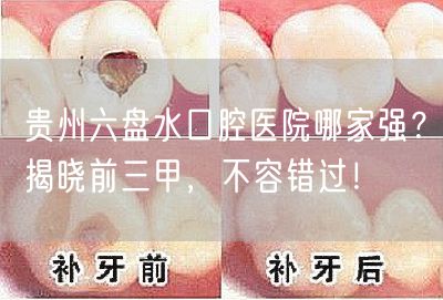 贵州六盘水口腔医院哪家强？揭晓前三甲，不容错过！
