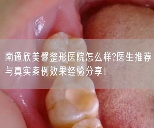 南通欣美馨整形医院怎么样?医生推荐与真实案例效果经验分享！