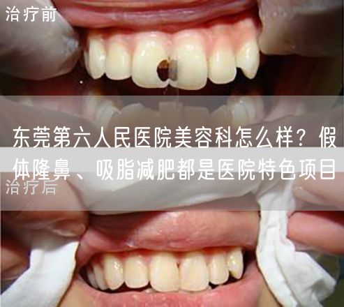 东莞第六人民医院美容科怎么样？假体隆鼻、吸脂减肥都是医院特色项目