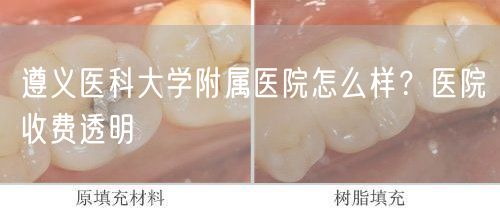 遵义医科大学附属医院怎么样？医院收费透明