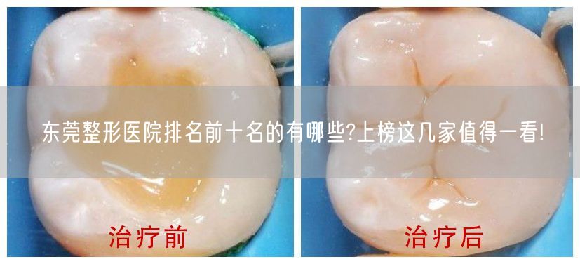 东莞整形医院排名前十名的有哪些?上榜这几家值得一看!