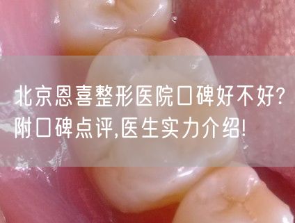 北京恩喜整形医院口碑好不好?附口碑点评,医生实力介绍!