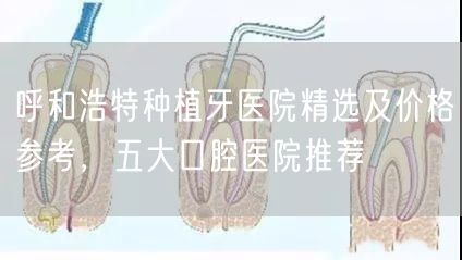 呼和浩特种植牙医院精选及价格参考，五大口腔医院推荐(图1)