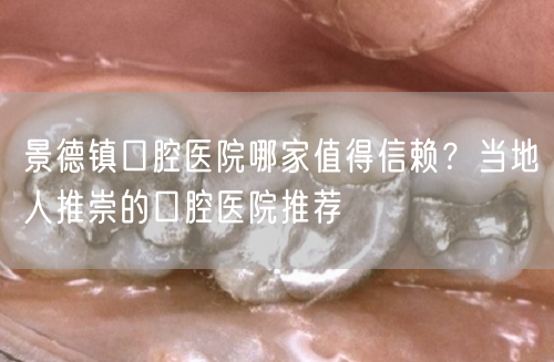 景德镇口腔医院哪家值得信赖？当地人推崇的口腔医院推荐(图1)