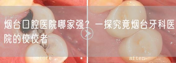 烟台口腔医院哪家强？一探究竟烟台牙科医院的佼佼者(图1)