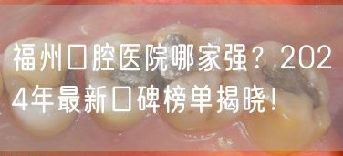 福州口腔医院哪家强？2024年最新口碑榜单揭晓！