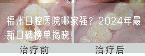 福州口腔医院哪家强？2024年最新口碑榜单揭晓！(图1)