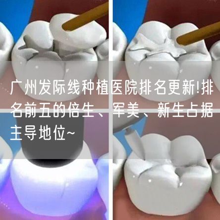 广州发际线种植医院排名更新!排名前五的倍生、军美、新生占据主导地位~