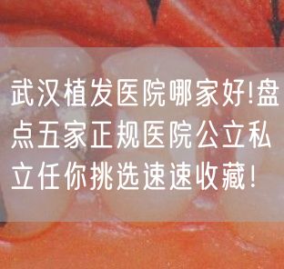 武汉植发医院哪家好!盘点五家正规医院公立私立任你挑选速速收藏！